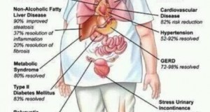 Benefits When you Lose Fats